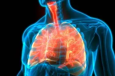 Atualização no tratamento Da Hipertensão Arterial Pulmonar