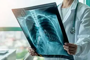 Hipertensão Pulmonar na Esquistossomose