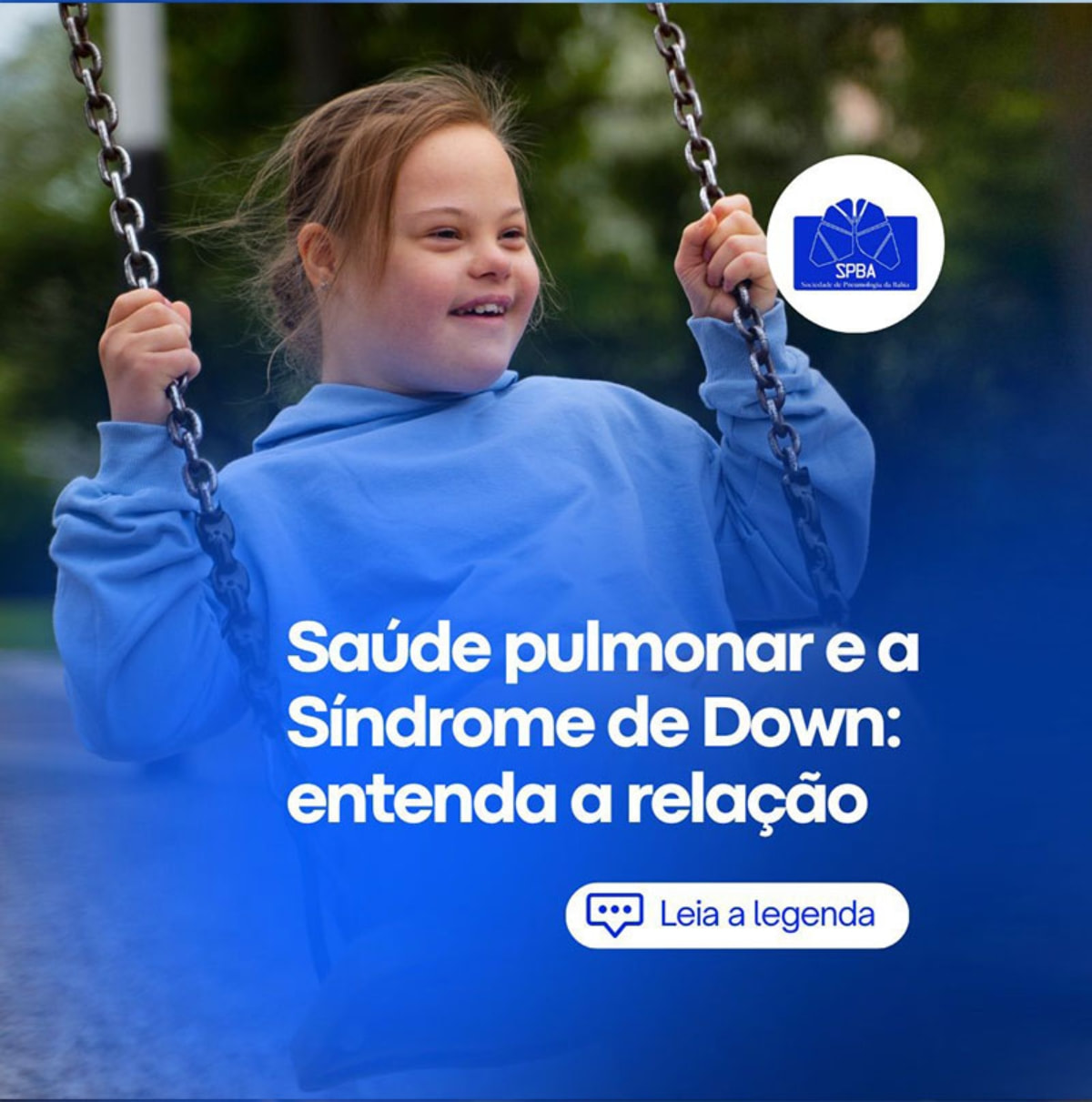 SÍNDROME DE DOWN E DOENÇAS RESPIRATÓRIAS